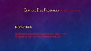 CERVICAL DISC PROSTHESIS MOBI-C (LDR ZIMVIE)
MOBI-C Risk
Dislocation described including one case in my
experience with very important osteolysis !
 