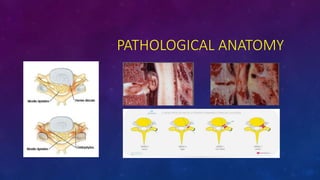 PATHOLOGICAL ANATOMY
 