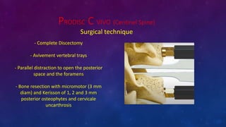PRODISC C VIVO (Centinel Spine)
Surgical technique
- Complete Discectomy
- Avivement vertebral trays
- Parallel distraction to open the posterior
space and the foramens
- Bone resection with micromotor (3 mm
diam) and Kerisson of 1, 2 and 3 mm
posterior osteophytes and cervicale
uncarthrosis
 