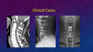 Clinical Cases
 