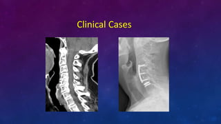 Clinical Cases
 