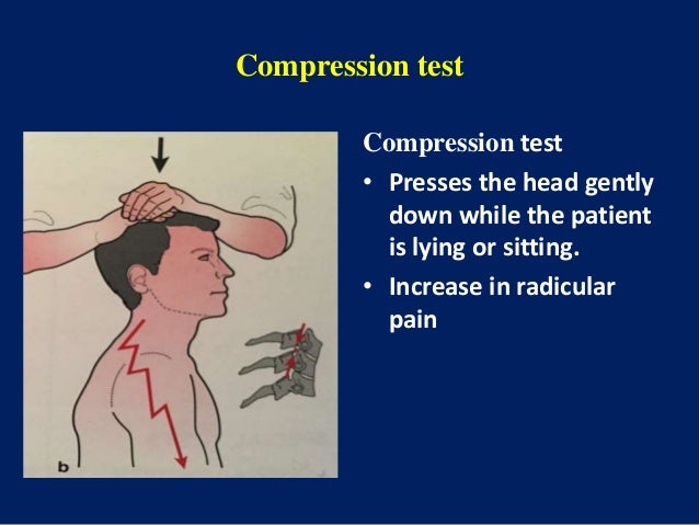 Cervical disc prolapse Cervical disc prolapse