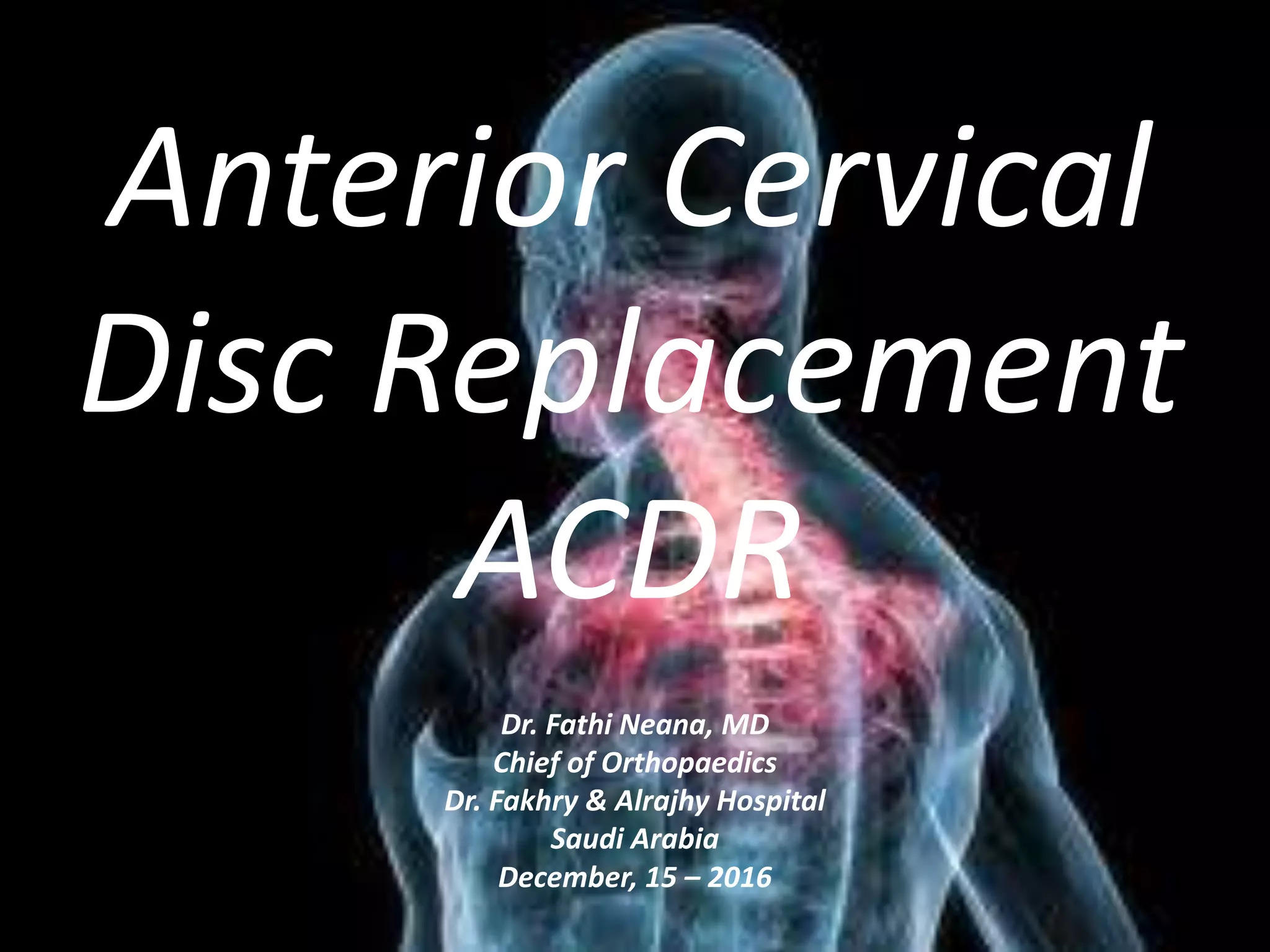 Cervical Disc Replacement | PPTX