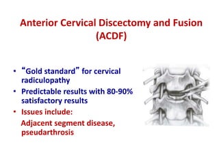 Cervical Disc Replacement | PPTX