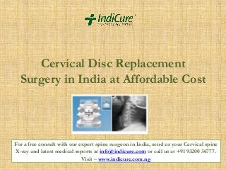 Cervical Disc Replacement
Surgery in India at Affordable Cost

For a free consult with our expert spine surgeon in India, send us your Cervical spine
X-ray and latest medical reports at info@indicure.com or call us at +91 93200 36777.
Visit – www.indicure.com.ng

 