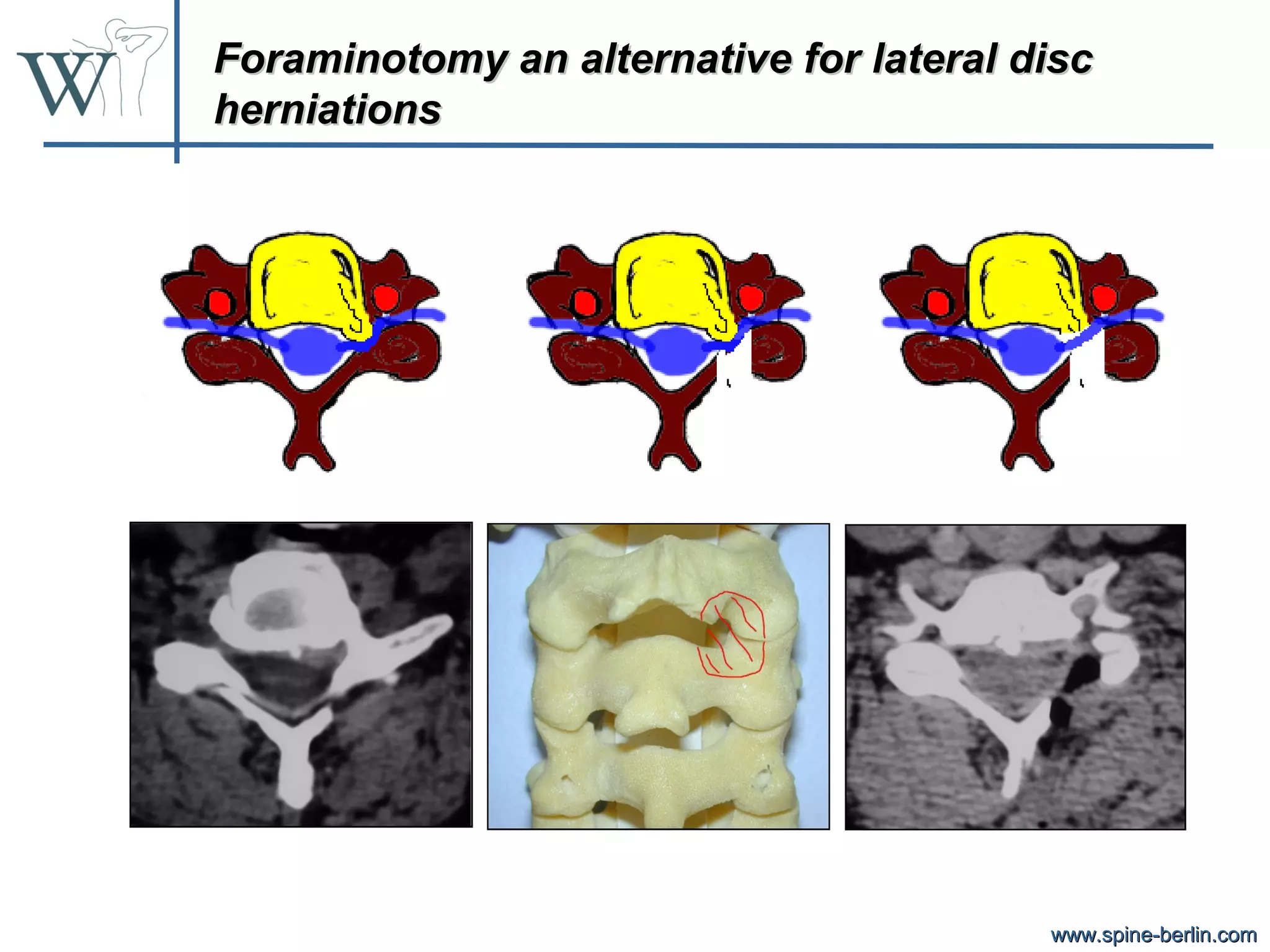 Cervical endoscopy | PPT