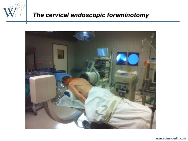 Cervical endoscopy