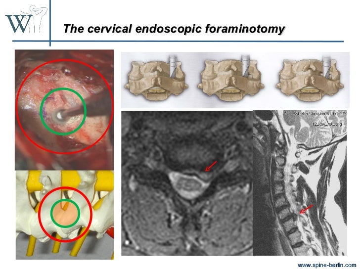 Cervical endoscopy