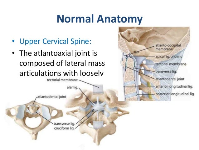 atlantoaxial joint