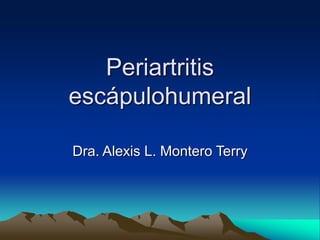 Periartritis
escápulohumeral
Dra. Alexis L. Montero Terry
 