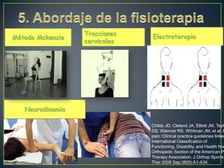 Método Mckenzie

Tracciones
cervicales

Electroterapia

Neurodinamia

Childs JD, Cleland JA, Elliott JM, Teyh
DS, Wainner RS, Whitman JM, et al. N
pain: Clinical practice guidelines linked
International Classification of
Functioning, Disability, and Health from
Orthopedic Section of the American P
Therapy Association. J Orthop Sports
Ther 2008 Sep;38(9):A1-A34.

 