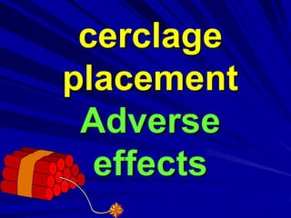 cerclage
placement
Adverse
effects
 
