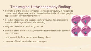 Transvaginal Ultrasonography Findings
• ‘Funneling’ of the internal cervical os (at rest or particularly in respond to
transabdominal pressure on the uterine fundus) is the ultrasonographic
appearance of cervical incompetence.
• Y= initial effacement and subsequent V, U visualized on progressive
endocervial change and cervical shortening.
• length of the cervical canal: <2.5cm – risk
• diameter of the internal os:>15 mm in the 1st trimester and > 20mm in
the 2nd
trimester
• protrusion of the fetal membranes through the os
• presence of fetal parts in the cervix or vagina
18
 