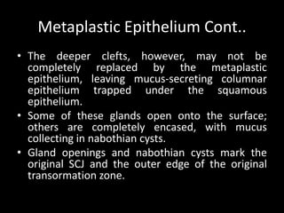 Metaplastic Epithelium Cont..
• The deeper clefts, however, may not be
  completely replaced by the metaplastic
  epithelium, leaving mucus-secreting columnar
  epithelium trapped under the squamous
  epithelium.
• Some of these glands open onto the surface;
  others are completely encased, with mucus
  collecting in nabothian cysts.
• Gland openings and nabothian cysts mark the
  original SCJ and the outer edge of the original
  transormation zone.
 