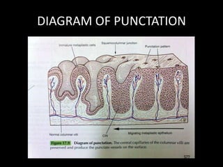DIAGRAM OF PUNCTATION
 