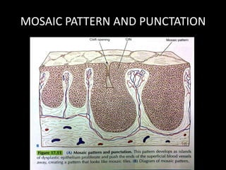 MOSAIC PATTERN AND PUNCTATION
 