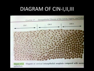 DIAGRAM OF CIN-I,II,III
 