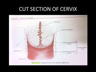 CUT SECTION OF CERVIX
 