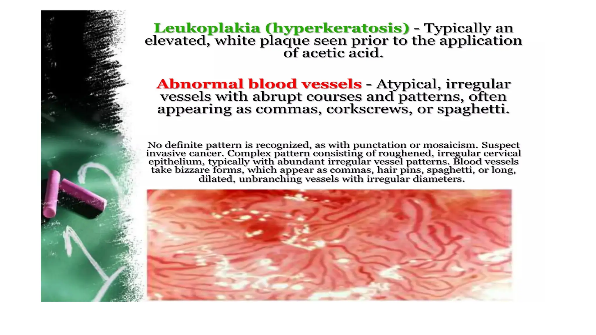 Cervical intraepithelial neoplasia.dpptx