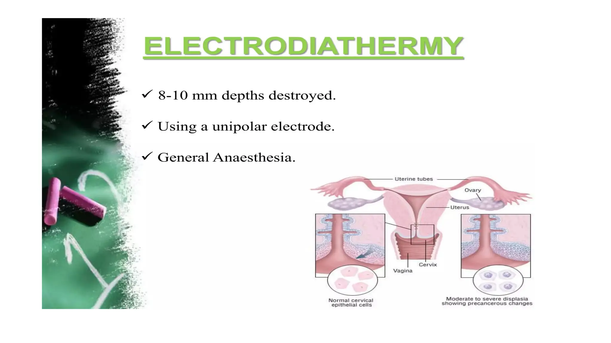 Cervical intraepithelial neoplasia.dpptx