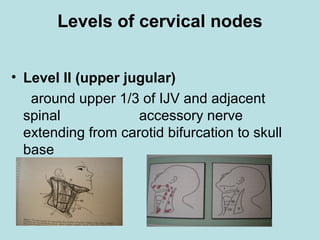 Levels of cervical nodes
• Level II (upper jugular)
around upper 1/3 of IJV and adjacent
spinal accessory nerve
extending from carotid bifurcation to skull
base
 
