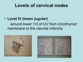 Levels of cervical nodes
• Level IV (lower jugular)
around lower 1/3 of IJV from cricothyroid
membrane to the clavicle inferorly
 
