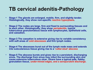 TB cervical adenitis-Pathology
• Stage-1 The glands are enlarged, mobile, firm, and slightly tender.
Histologically, they show non-specific reactive hyperplasia.
• Stage-2 The nodes are large, firm and fixed to surrounding tissues and
to each other. Histologically, they show periadenitis, typical
tuberculous granulomatous tissue with lymphocytes, epithelioid cells,
and caesation.
• Stage-3 The caesation is extensive giving rise to variable consistency
with soft areas of cold abscesses and firm lymph nodes.
• Stage-4 The abscesses burst out of the lymph node mass and extends
into subcutaneous tissue giving rise to a ‘collar-stud’ abscess
• Stage-5 The abscess bursts and gives rise to a persistent, discharging
sinus. The discharge from sinus may infect the surrounding skin and
cause extensive tuberculous ulcer. Ulcers have a typical pale, flabby,
granulation tissue, under-mined edges, and a seropurulent discharge.
 