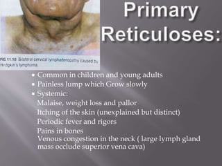  Common in children and young adults
 Painless lump which Grow slowly
 Systemic:
Malaise, weight loss and pallor
Itching of the skin (unexplained but distinct)
Periodic fever and rigors
Pains in bones
Venous congestion in the neck ( large lymph gland
mass occlude superior vena cava)
 