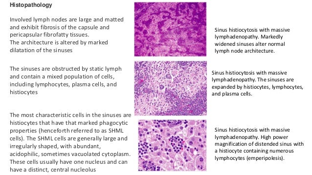 In The Know About Lymph Nodes Fields Ppt Download