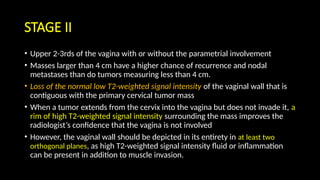Imaging in cervical Malignancy radiology.pptx