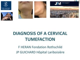 DIAGNOSIS OF A CERVICAL
TUMEFACTION
F HERAN Fondation Rothschild
JP GUICHARD Hôpital Lariboisière
 
