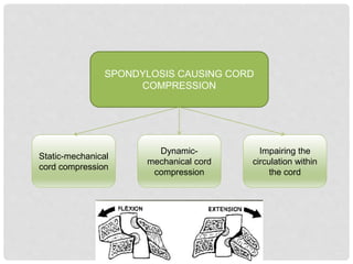 Static-mechanical
cord compression
Dynamic-
mechanical cord
compression
Impairing the
circulation within
the cord
SPONDYLOSIS CAUSING CORD
COMPRESSION
 