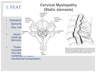 1. STATIC-MECHANICAL COMPRESSION
OF THE CORD
• Osteophytes
• Spinal ligaments
• Disc material
 which encroach upon the
canal space resulting in
stenosis of the canal
 Those with a congenitally
narrowed spinal canal (10-13
mm) are especially
vulnerable to static-
mechanical compression
 