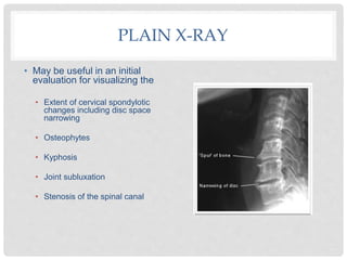 PLAIN X-RAY
• May be useful in an initial
evaluation for visualizing the
• Extent of cervical spondylotic
changes including disc space
narrowing
• Osteophytes
• Kyphosis
• Joint subluxation
• Stenosis of the spinal canal
 