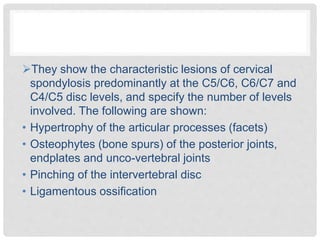 They show the characteristic lesions of cervical
spondylosis predominantly at the C5/C6, C6/C7 and
C4/C5 disc levels, and specify the number of levels
involved. The following are shown:
• Hypertrophy of the articular processes (facets)
• Osteophytes (bone spurs) of the posterior joints,
endplates and unco-vertebral joints
• Pinching of the intervertebral disc
• Ligamentous ossification
 