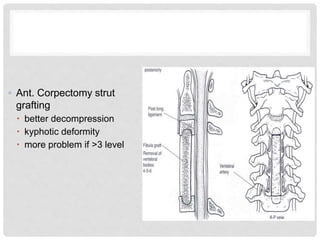 ◦ Ant. Corpectomy strut
grafting
 better decompression
 kyphotic deformity
 more problem if >3 level
 