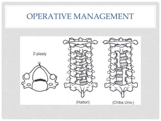 OPERATIVE MANAGEMENT
 