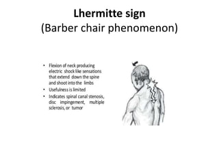 Lhermitte sign
(Barber chair phenomenon)
 