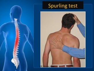 Spurling test
DR Mohsen Abad
 