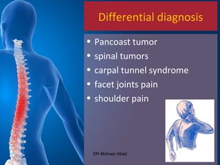 Differential diagnosis
• Pancoast tumor
• spinal tumors
• carpal tunnel syndrome
• facet joints pain
• shoulder pain
DR Mohsen Abad
 
