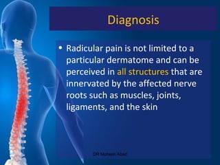 Diagnosis
• Radicular pain is not limited to a
particular dermatome and can be
perceived in all structures that are
innervated by the affected nerve
roots such as muscles, joints,
ligaments, and the skin
DR Mohsen Abad
 