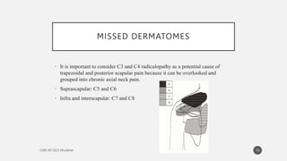 MISSED DERMATOMES
• It is important to consider C3 and C4 radiculopathy as a potential cause of
trapezoidal and posterior scapular pain because it can be overlooked and
grouped into chronic axial neck pain.
• Suprascapular: C5 and C6
• Infra and interscapular: C7 and C8
10
 