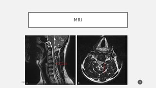 MRI
13
 