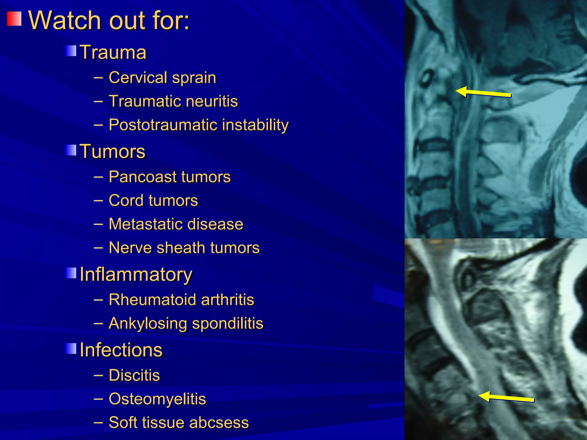 Cervical radiculopathy 1st mech diag 2008 | PPT