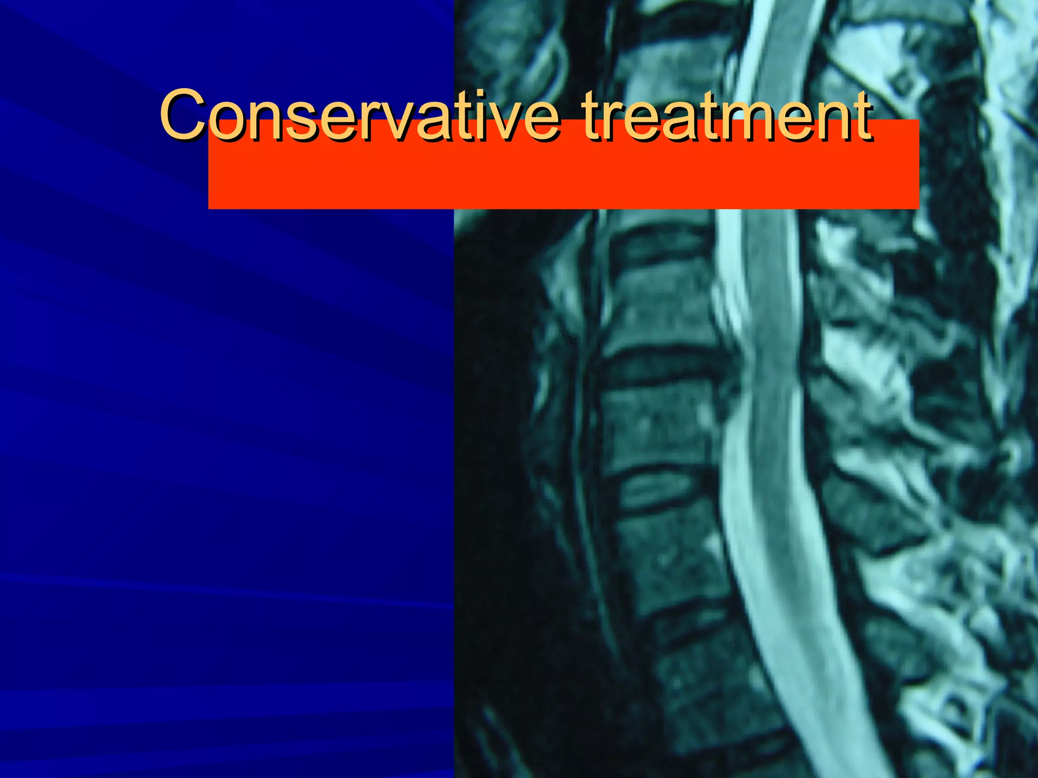 Cervical radiculopathy 1st mech diag 2008 | PPT