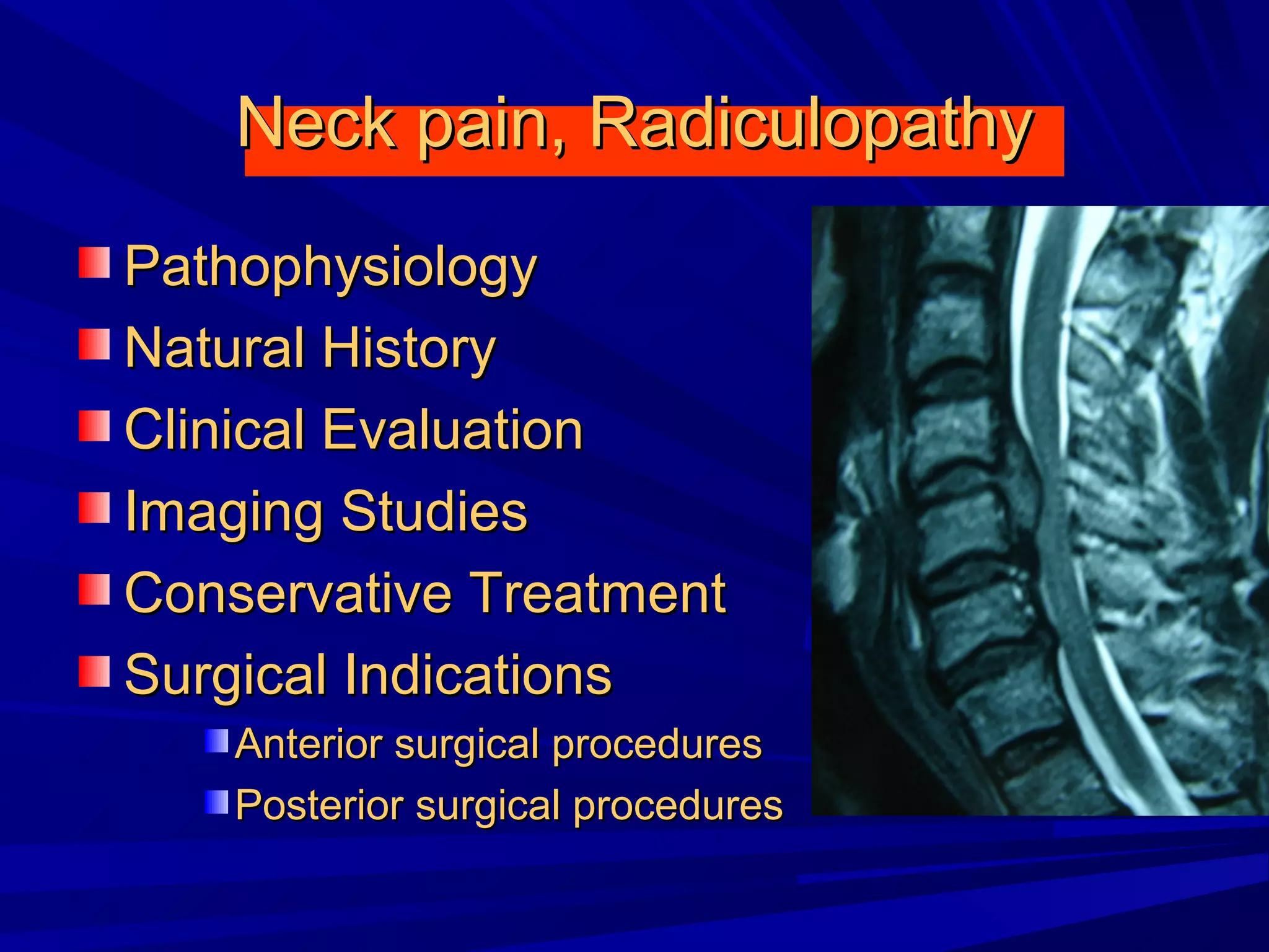 Cervical radiculopathy 1st mech diag 2008 | PPT