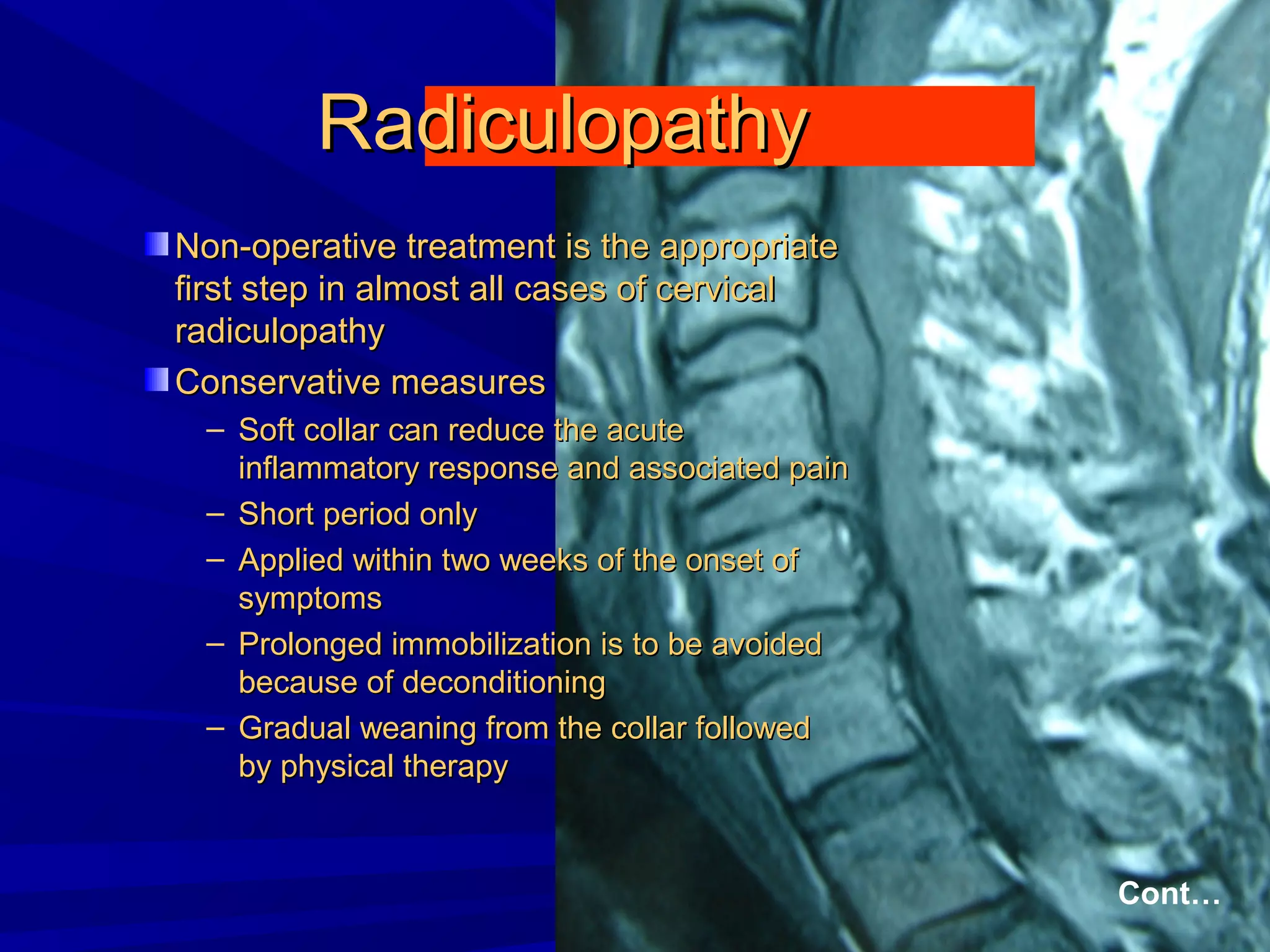 Cervical radiculopathy 1st mech diag 2008 | PPT