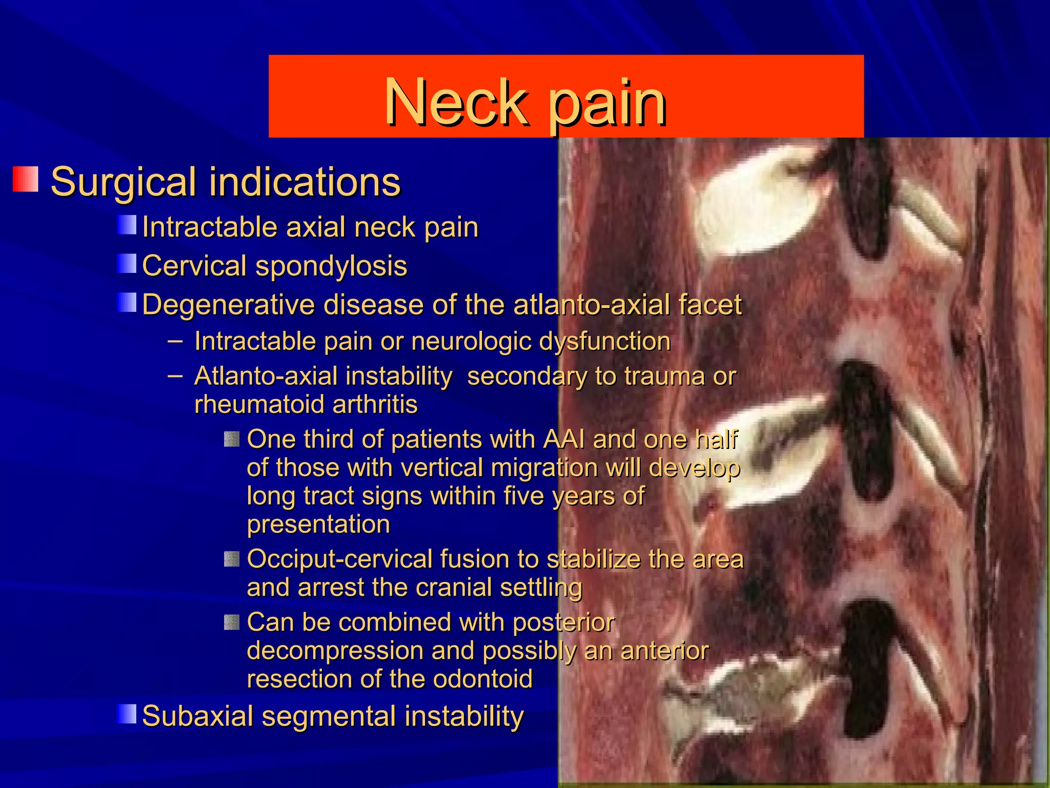 Cervical radiculopathy 1st mech diag 2008 | PPT