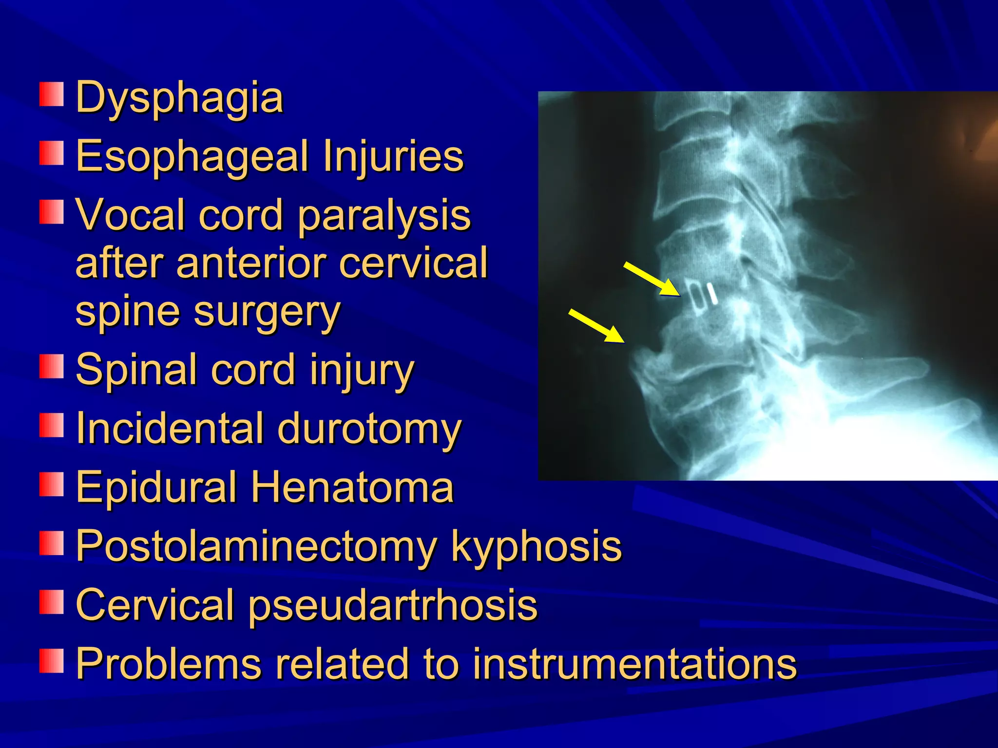 Cervical radiculopathy 1st mech diag 2008 | PPT