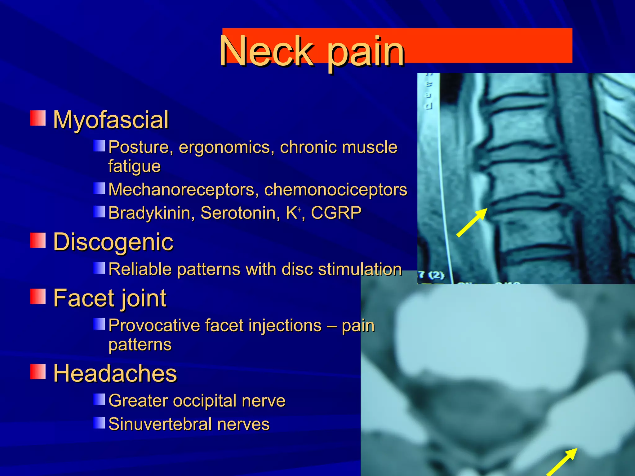 Cervical radiculopathy 1st mech diag 2008 | PPT